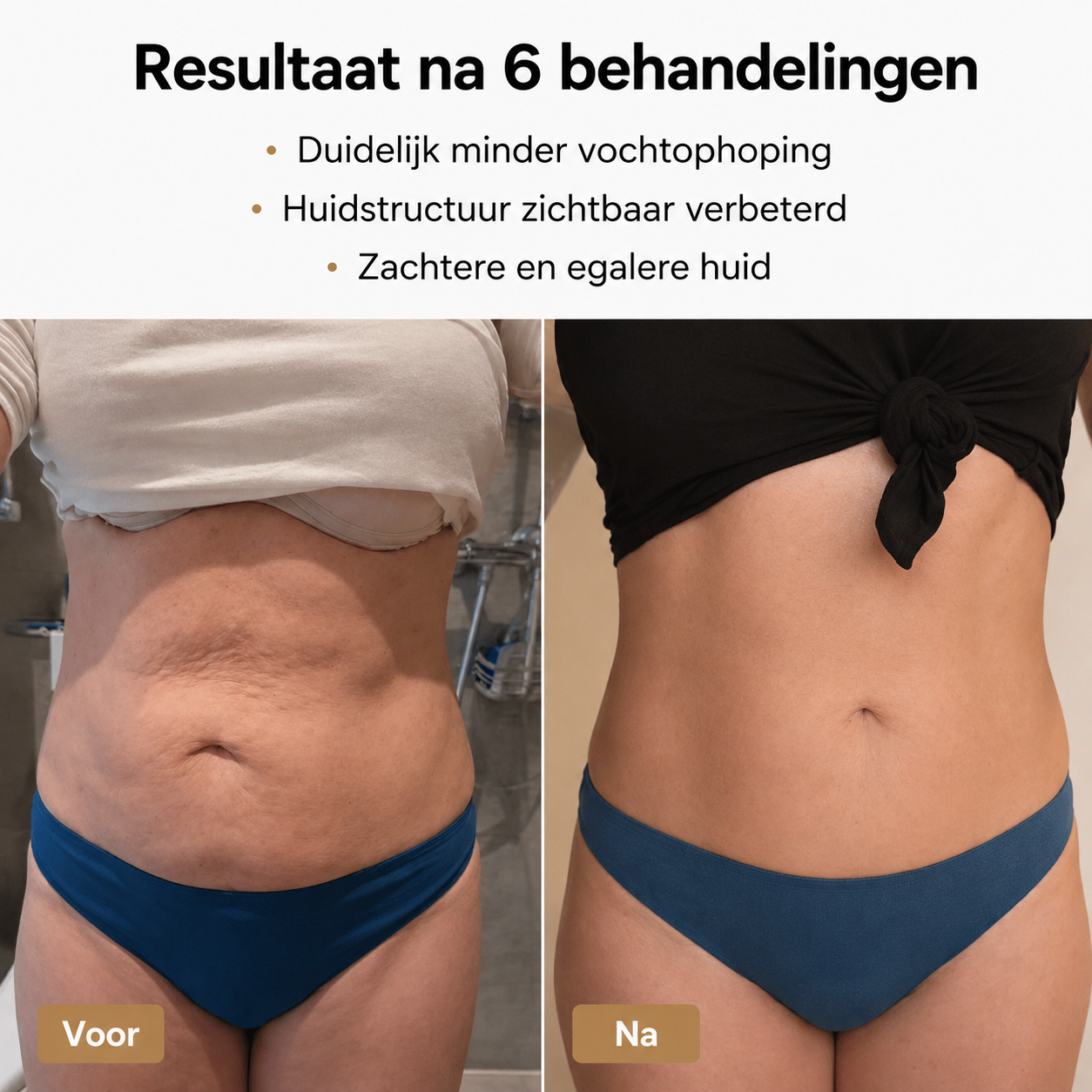 Contoura™ CupSculpt Vacuümmassage