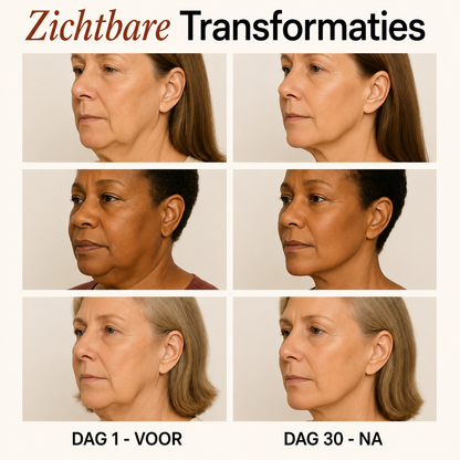 Sculptiva NeckLift - LED Nek & Kin Behandeling