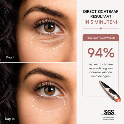 Luméva™ EyeLift Pro