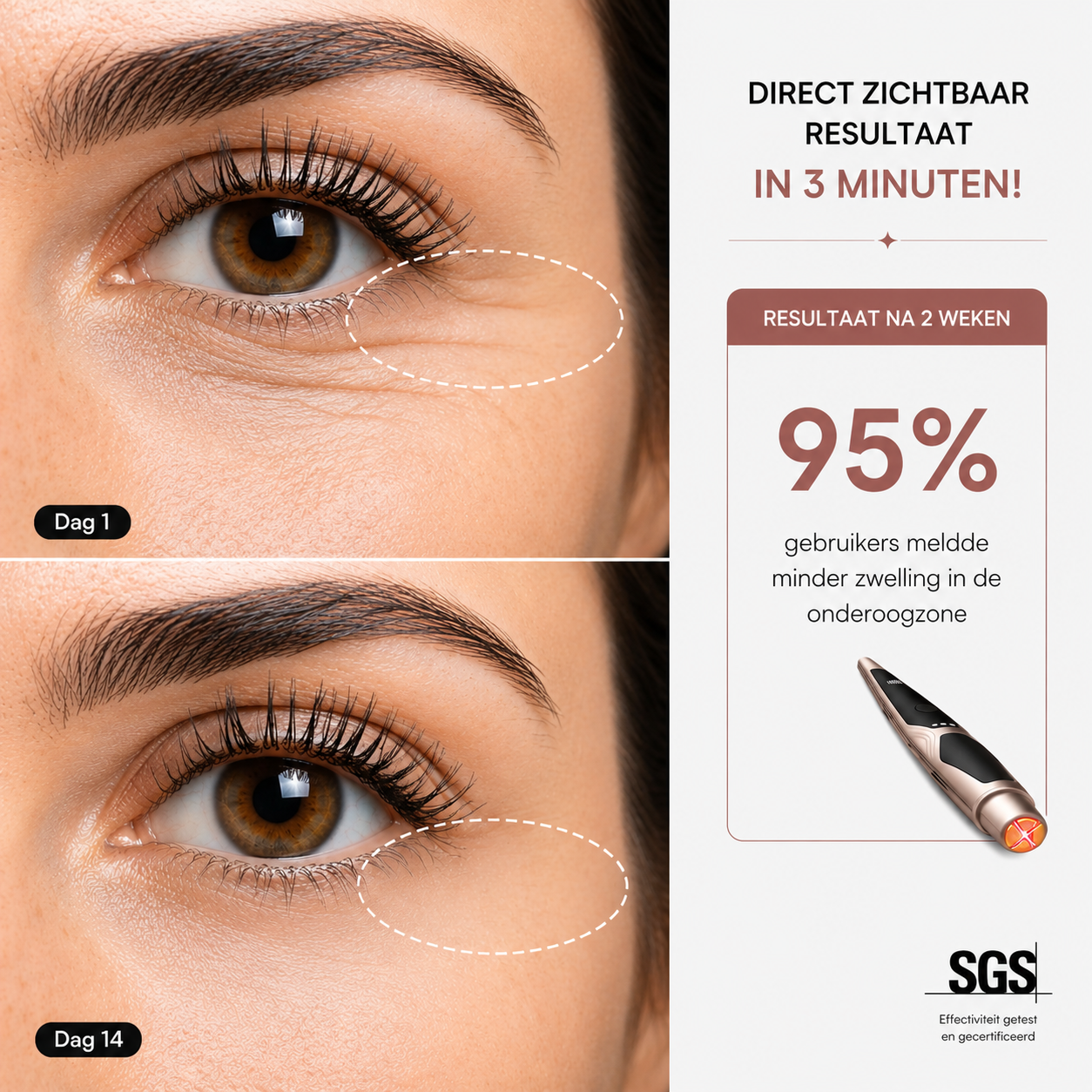 Luméva™ EyeLift Pro