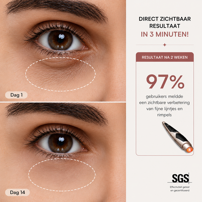 Luméva™ EyeLift Pro
