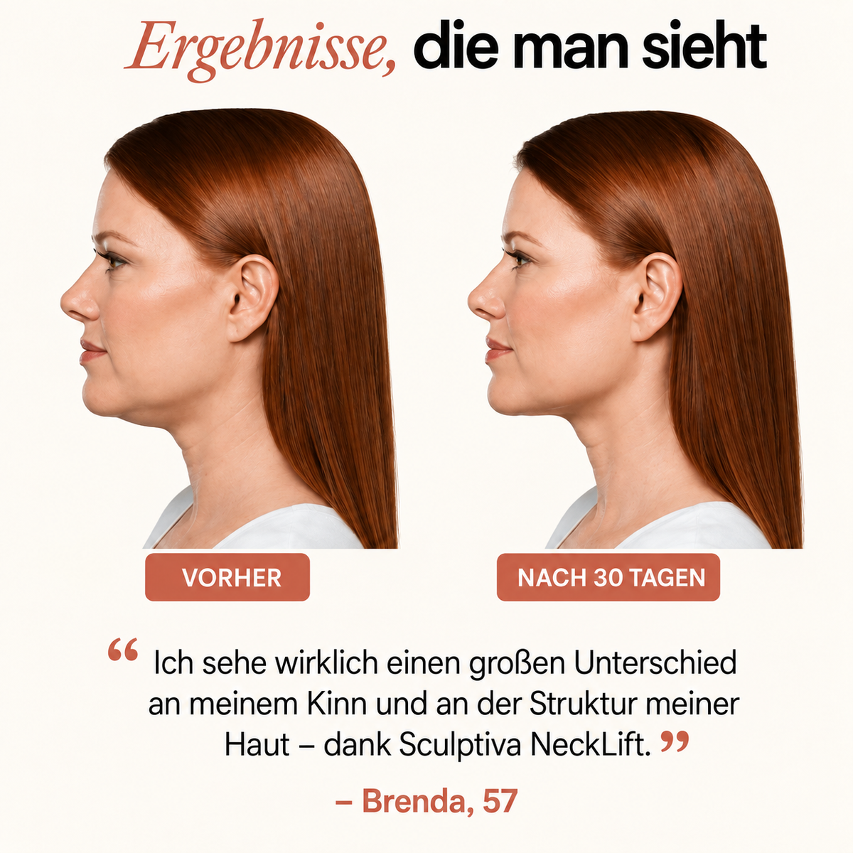 Sculptiva NeckLift - LED Nek & Kin Behandeling