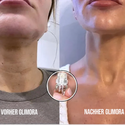 Glimora™ - Micro-Infusion Gezichtsset
