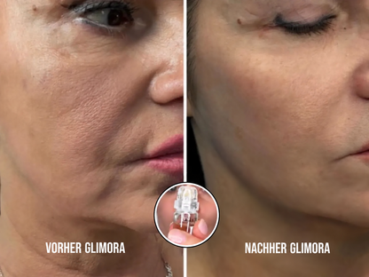 Glimora™ - Micro-Infusion Gezichtsset