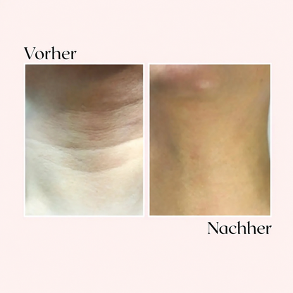 Glimora™ - Micro-Infusion Gezichtsset