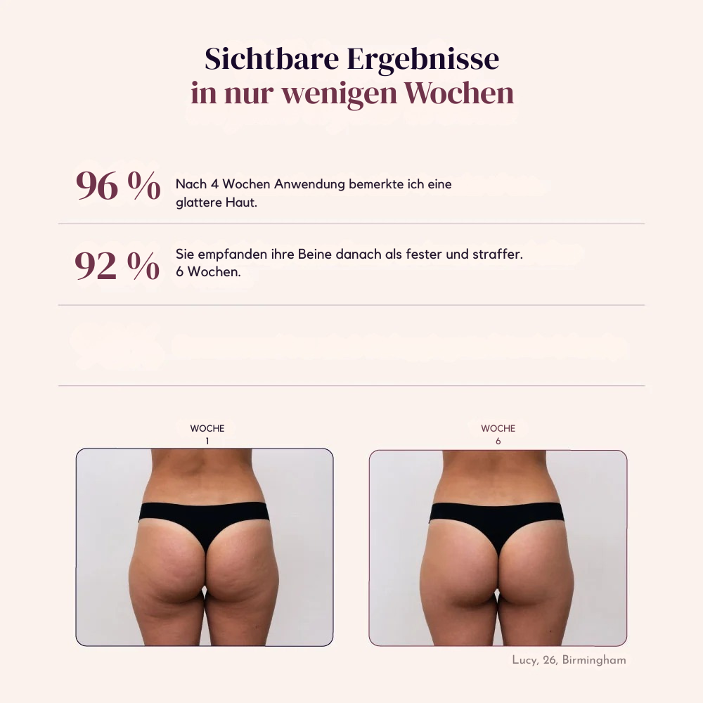 Sveltiva™ ContourFit - 3D-gebreide Contourlegging met Hoge Taille
