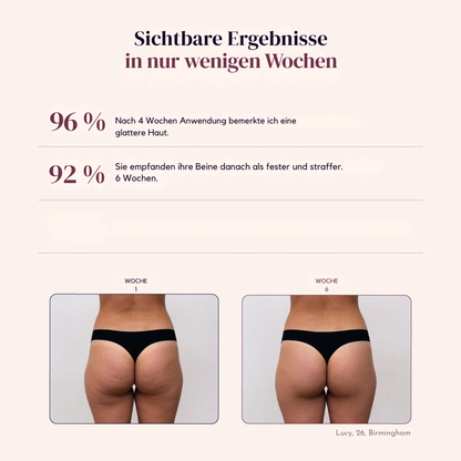 Sveltiva™ ContourFit - 3D-gebreide Contourlegging met Hoge Taille